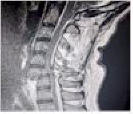 Luke Taylor MRI