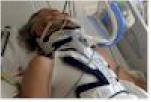 Luke Taylor ICU Day 2