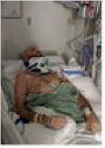 Luke Taylor ICU Day 3