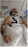 Luke Taylor ICU Day 4